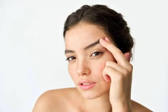 Endoscopic brow lift