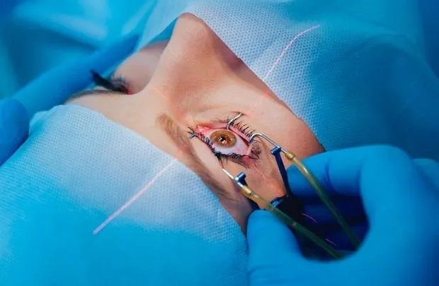 LASIK eye surgery costs