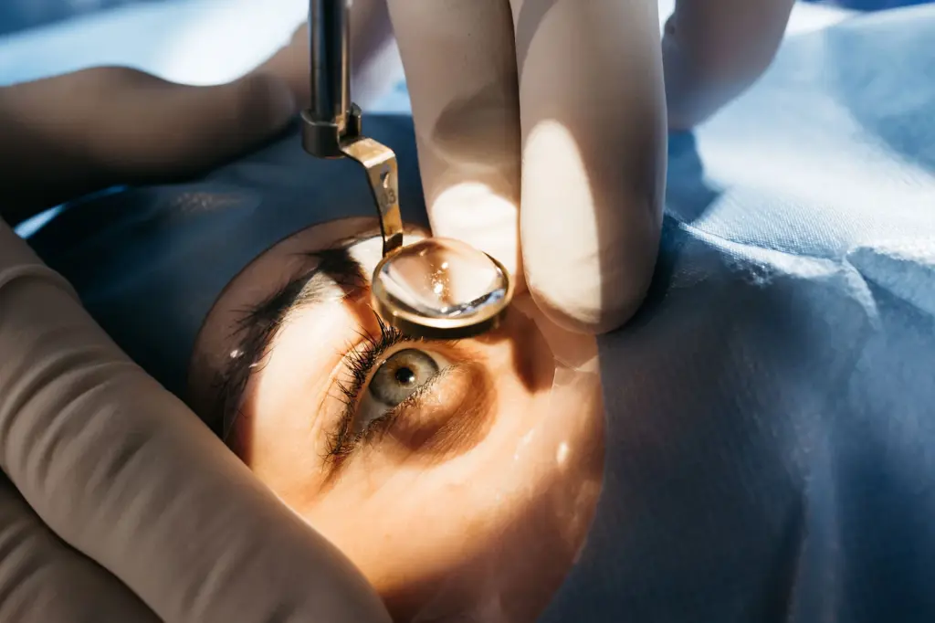 LASIK eye surgery in Turkey