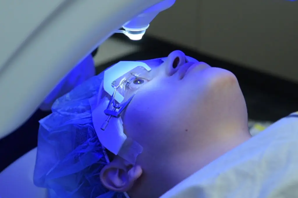 SMILE eye surgery