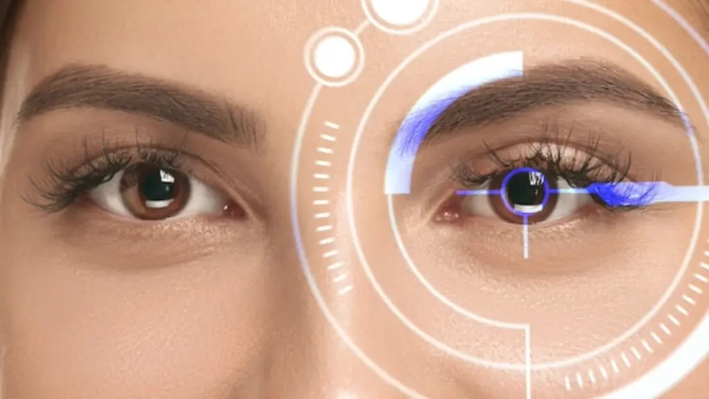 SMILE eye surgery