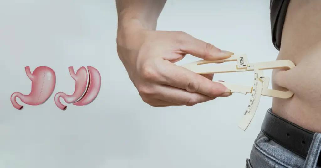 Kilo Verme Ameliyatı Fiyatı ve Başarı Oranı 1 Weight Loss Surgery
