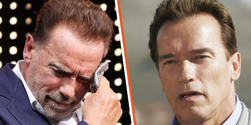 arnold schwarzenegger plastic surgery2