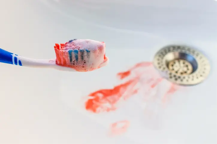 Zahnfleischbluten Ursachen, Behandlung & Was wirklich hilft 3 bleeding gums when brushing