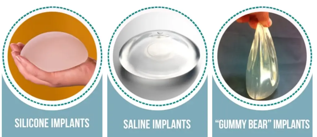 Arten von Brustimplantaten: Silikon vs Kochsalz, Formen & Größen 2 breast implant types