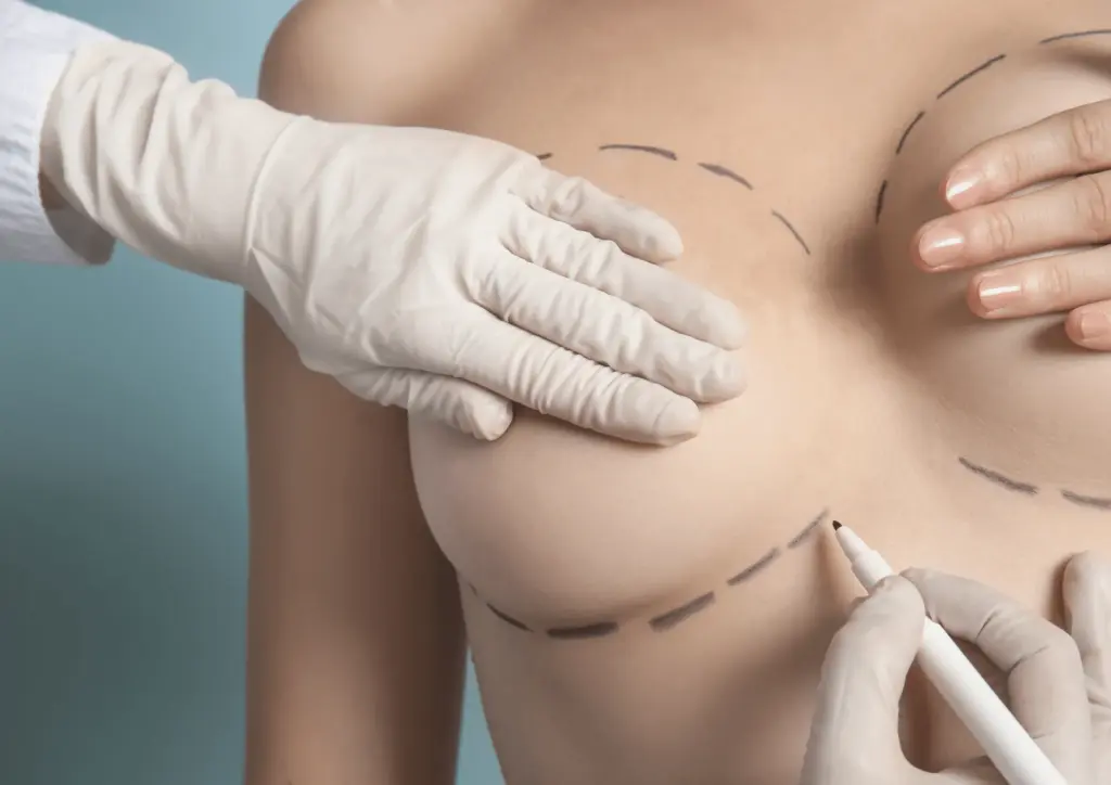 breastfeeding after breast lift and implants
