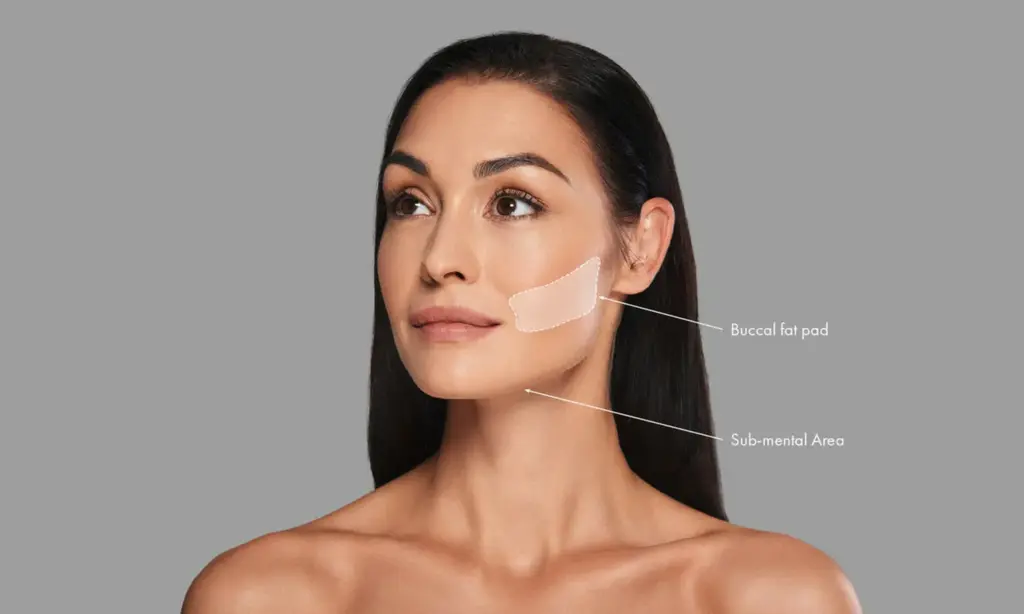 buccal fat removal cost