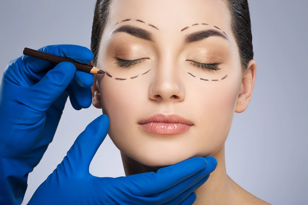 canthoplasty