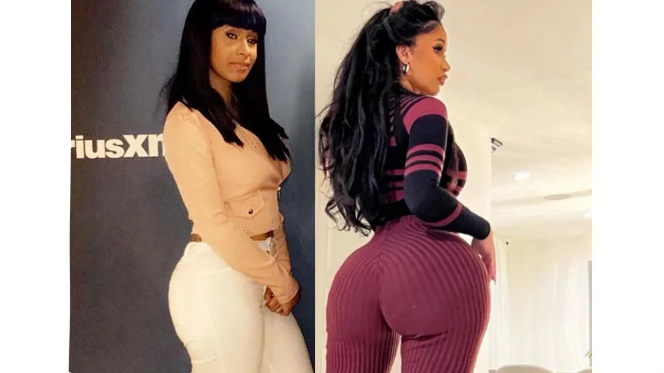 Cardi B BBL Surgery: Before & After Photos + Recovery Details