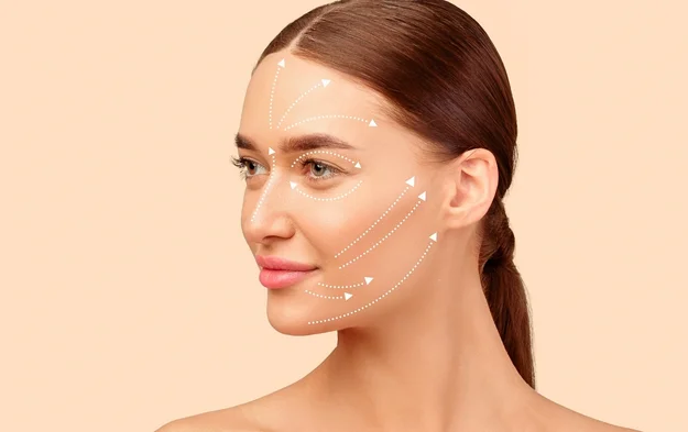 deep plane facelift