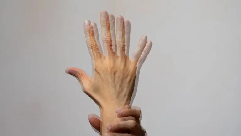 Was sind die Ursachen für Diplopie und wie wird sie behandelt? 1 diplopia