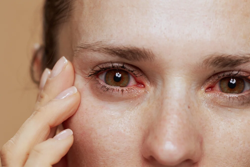 dry eye causes