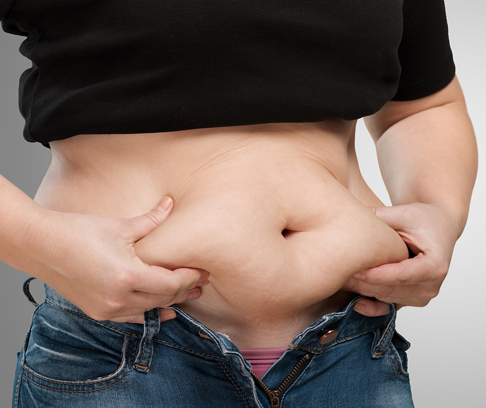 duodenal switch surgery