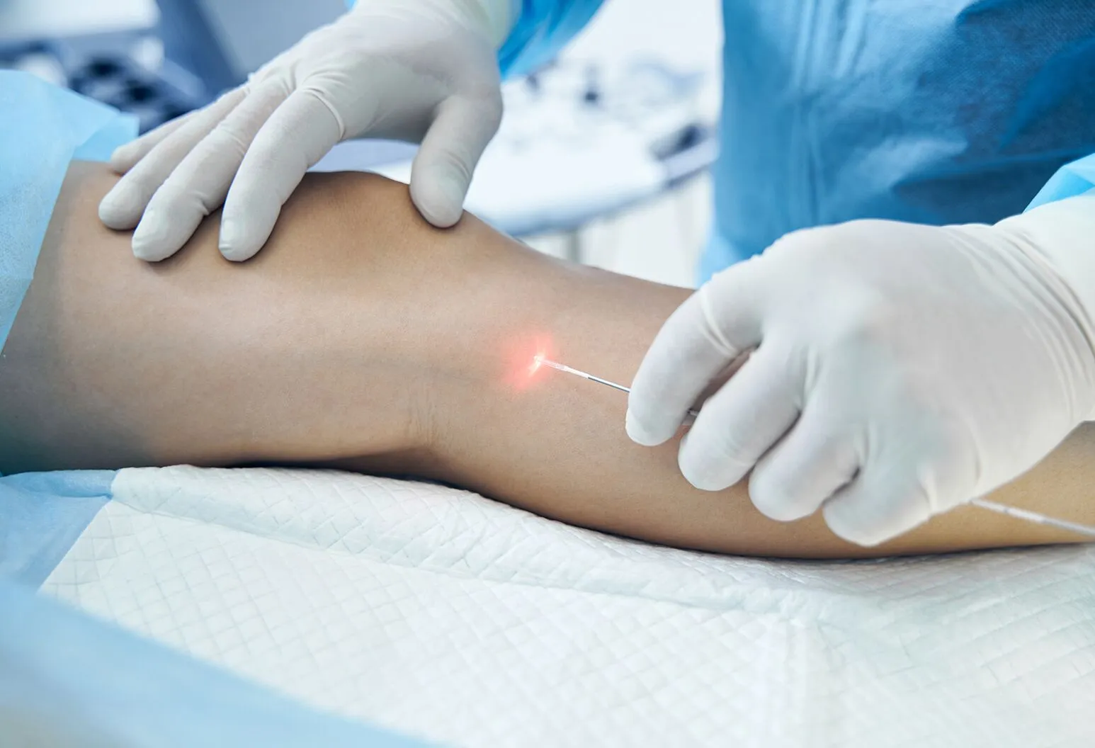 Endovenous Laser Ablation (EVLA): Procedure, Pain, Cost & Risks