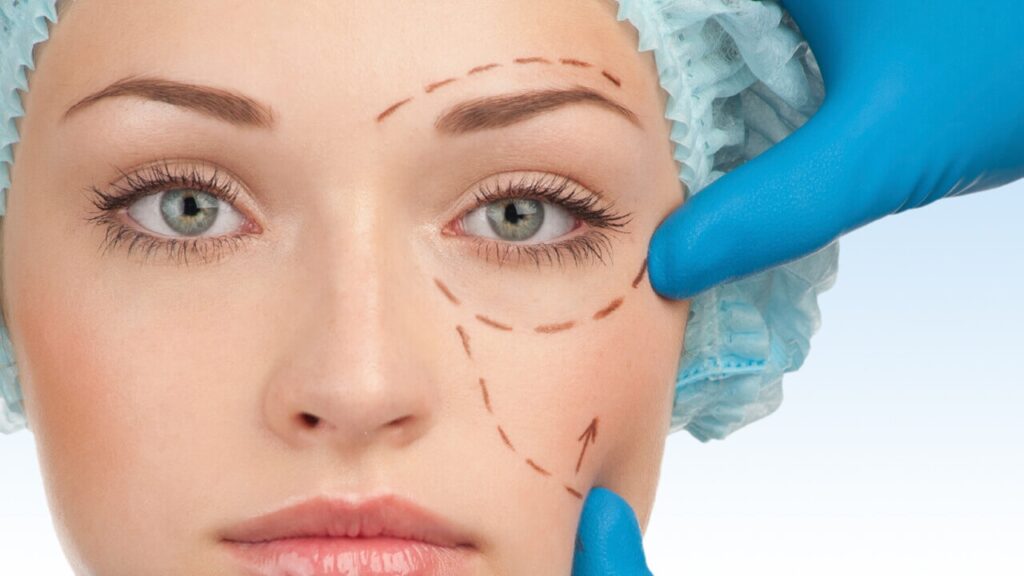 eyelid surgery aesthetic