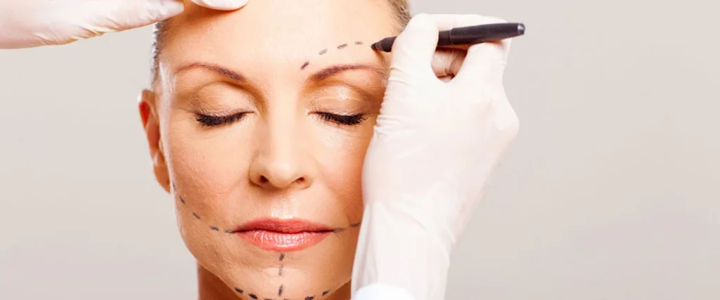 facelift surgery transformation