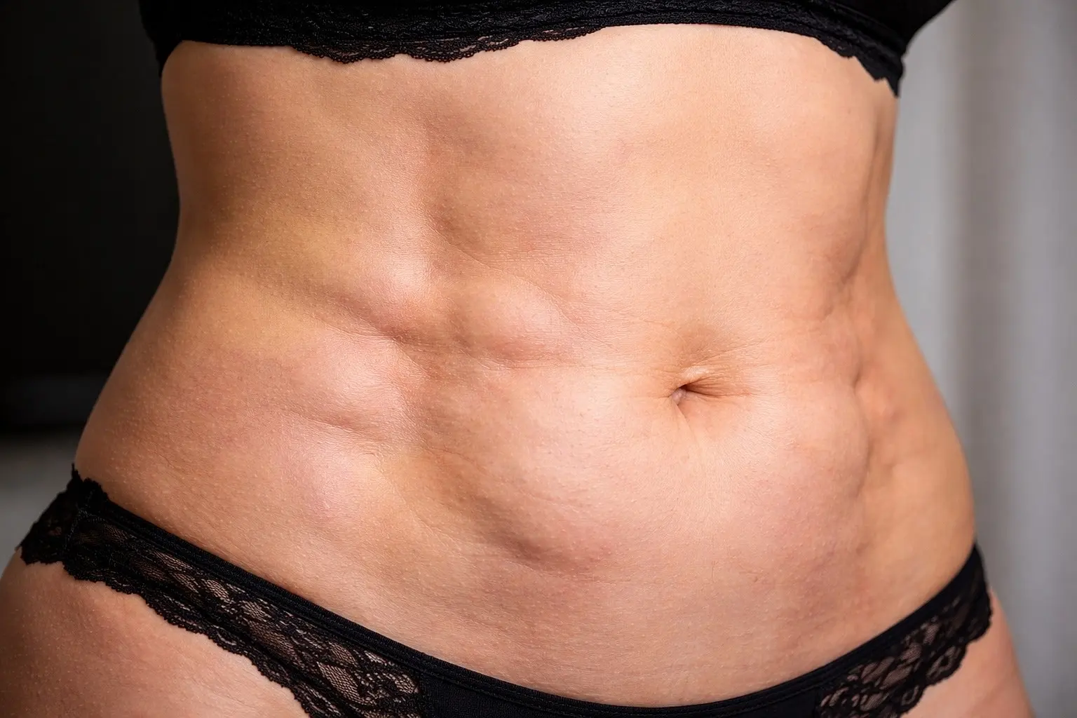 Fibrosis After Liposuction: Causes, Symptoms, Treatment