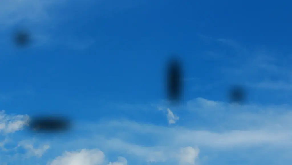 floaters in eyes causes