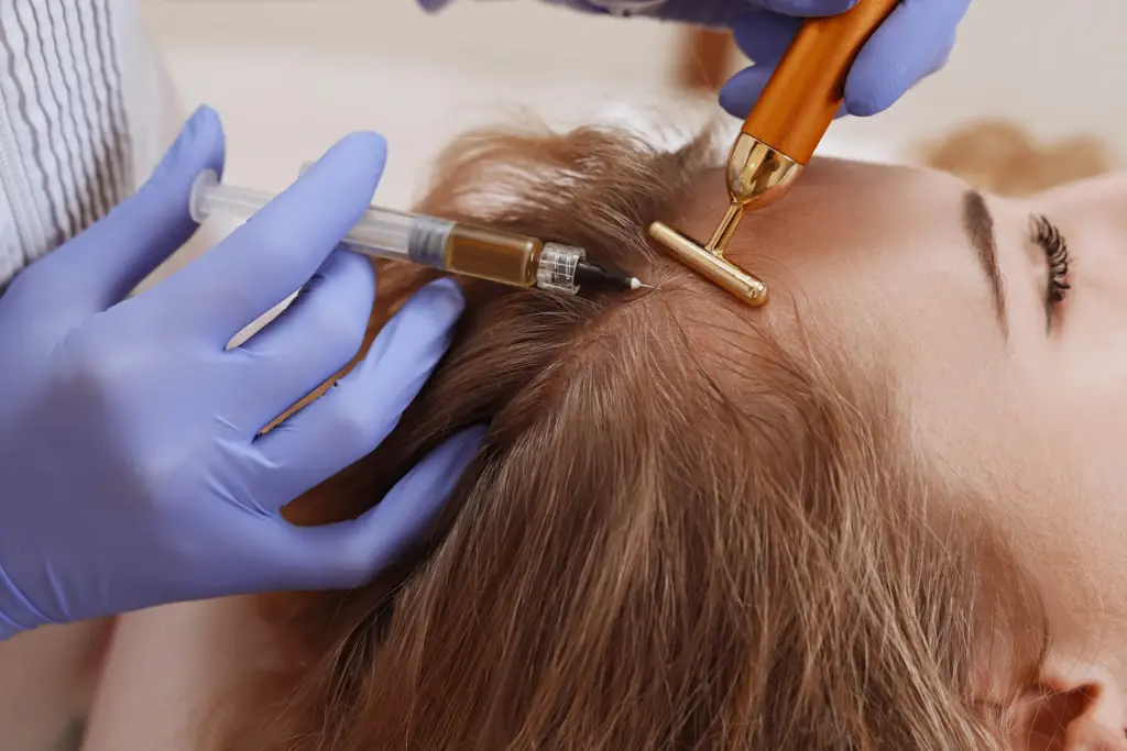 Hair Mesotherapy: Treatment, Products, Cost Factors & Results 1 hair mesotherapy