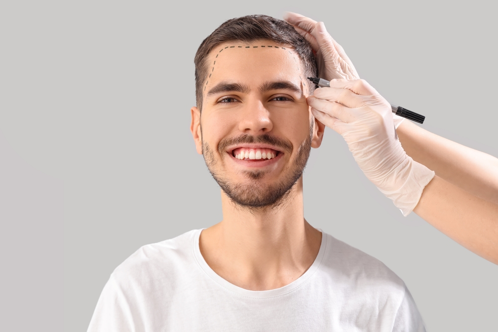hair transplant preparation