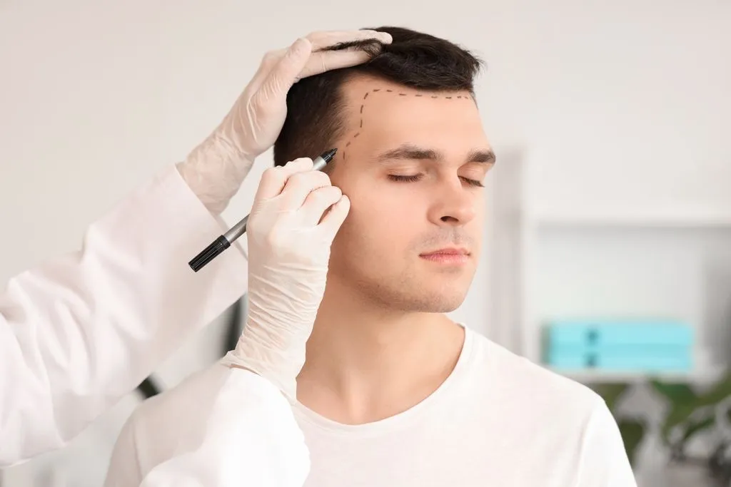 hair transplant turkey cost