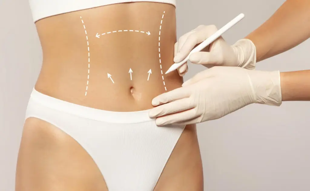 high definition liposuction