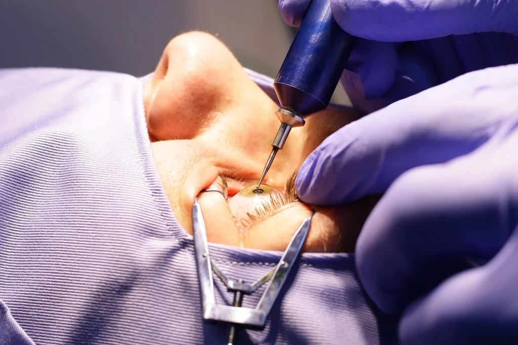 What Is ICL Surgery? Costs, Requirements & Recovery 3 icl surgery