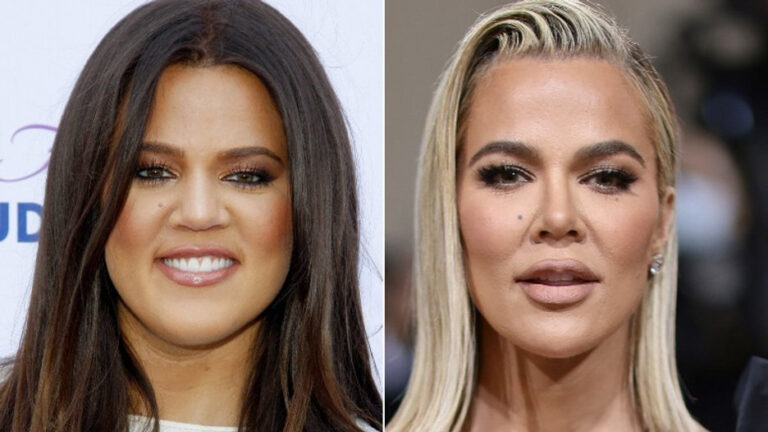 khloe kardashian plastic surgery reddit Image 1