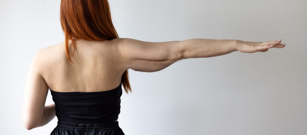 loose skin after weight loss