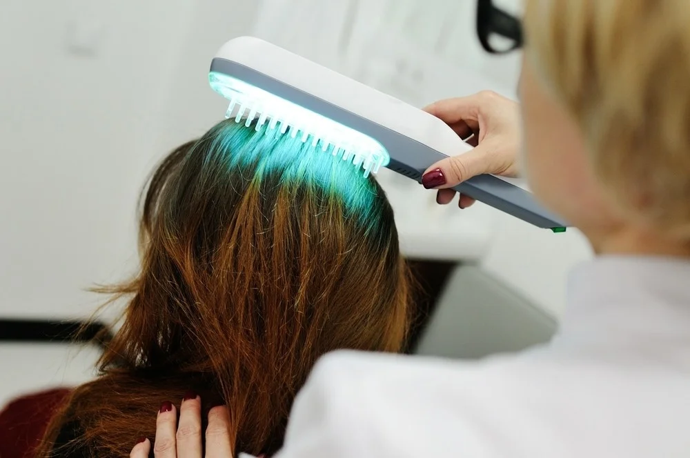low-level laser therapy hair loss