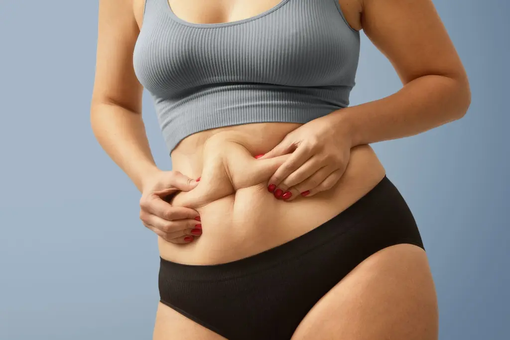 mini gastric bypass surgery 1