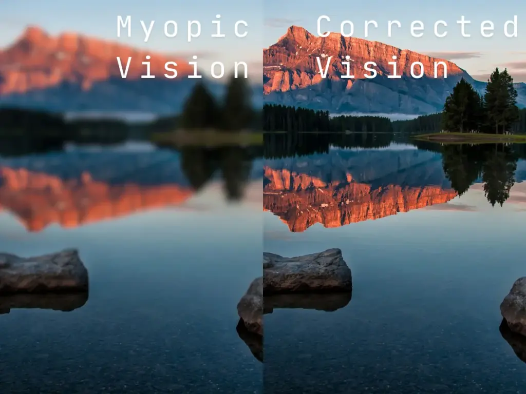 myopia