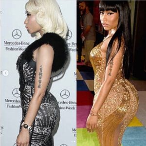 Nicki Minaj BBL Before and After