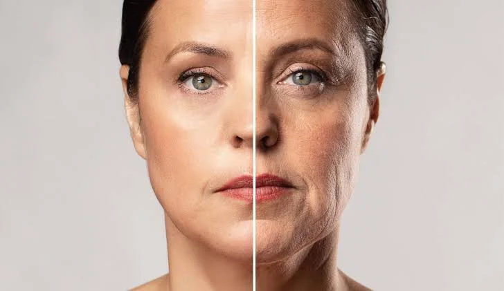 Ist Nicht-Chirurgisches Facelift Möglich? Wie Wird Es Durchgeführt? 3 non surgical face lift before after