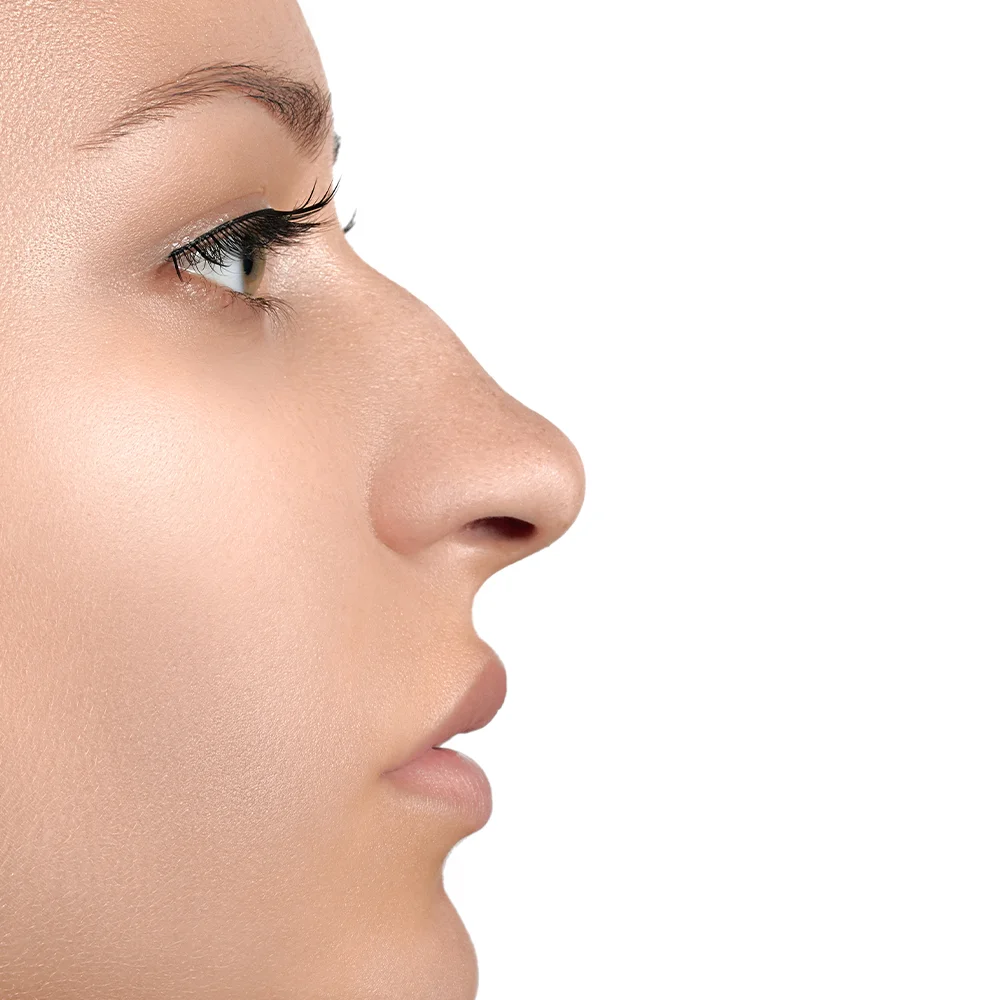 nose aquiline