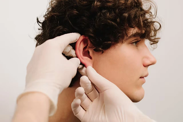 Otoplasty Surgery: Ear Pinning, Recovery, Cost & Before and After 1 otoplasty