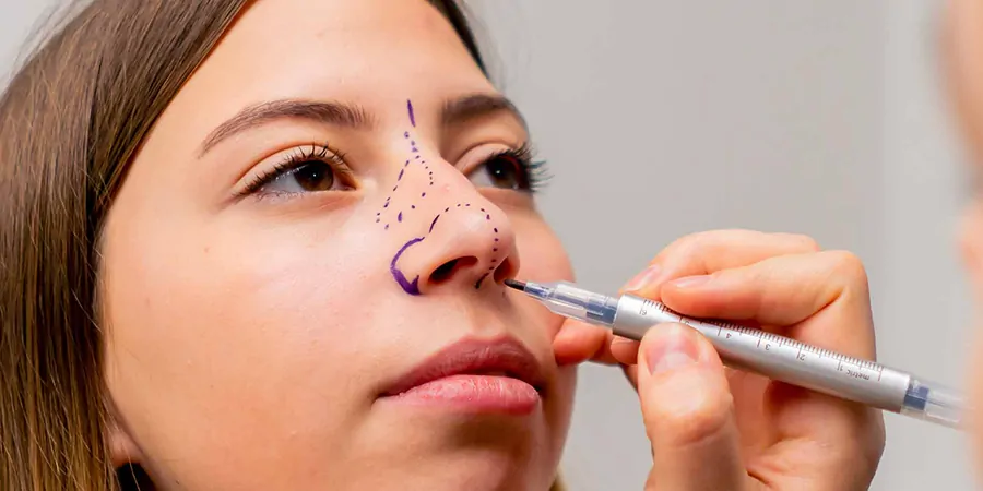 What is Piezo Rhinoplasty? Ultrasonic Technique, Cost & Recovery