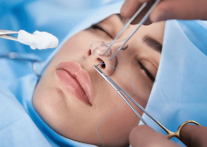 What is Piezo Rhinoplasty? Ultrasonic Technique, Cost & Recovery 2 piezo rhinoplasty