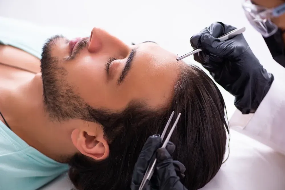 Haartransplantatie met 'Plugs': Herstel van Poppenhaar & Kosten 3 pluggy hair transplant