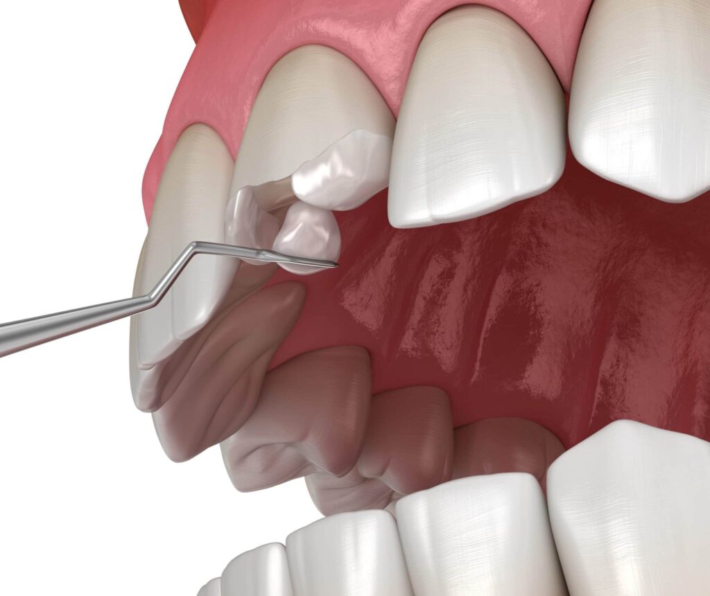 restorative dentistry treatment