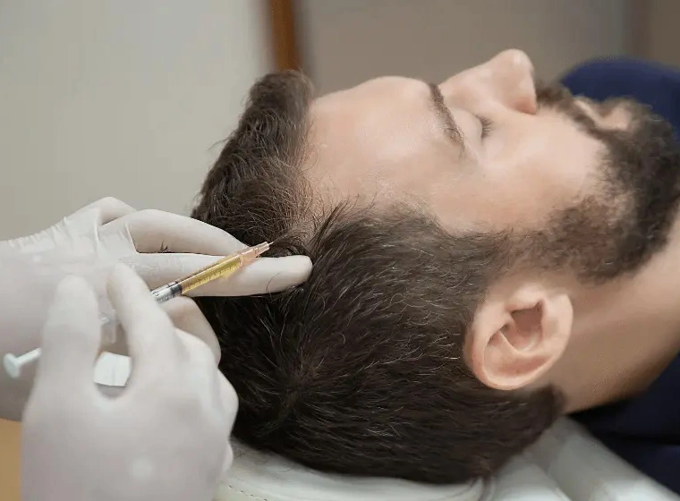 Stamcel Haartransplantatie: Kosten, Resultaten & Turkije Gids 2 stem cell hair transplant