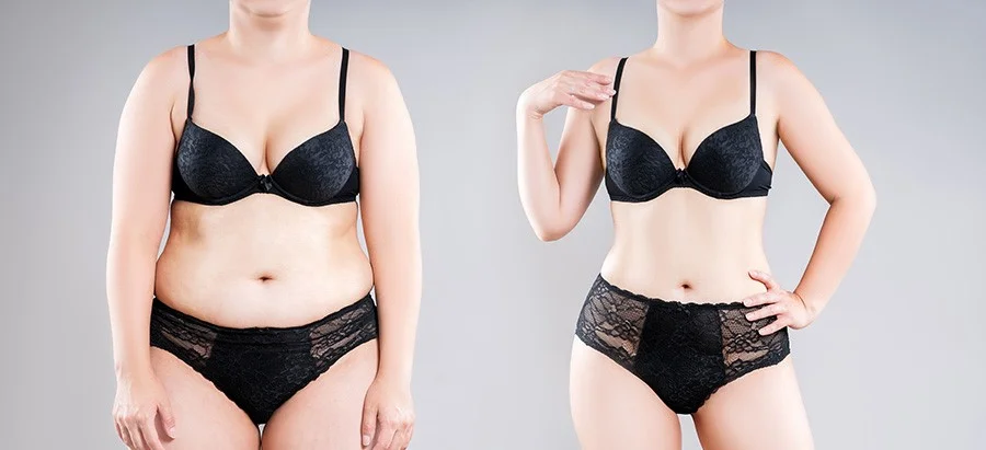 tummy tuck recovery