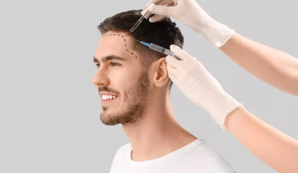 Haartransplantation ohne Rasur Ablauf, Kosten & Türkei 1 unshaven hair transplant cost