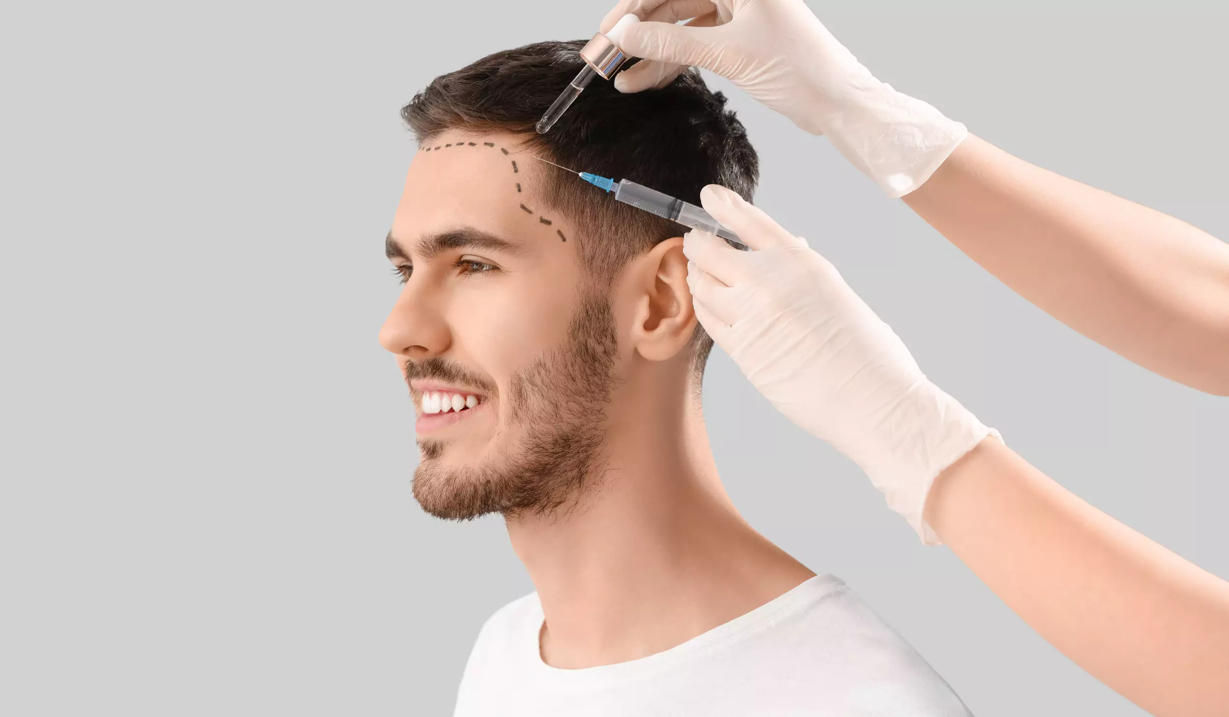 Unshaven Hair Transplant Recovery, Costs & Turkey