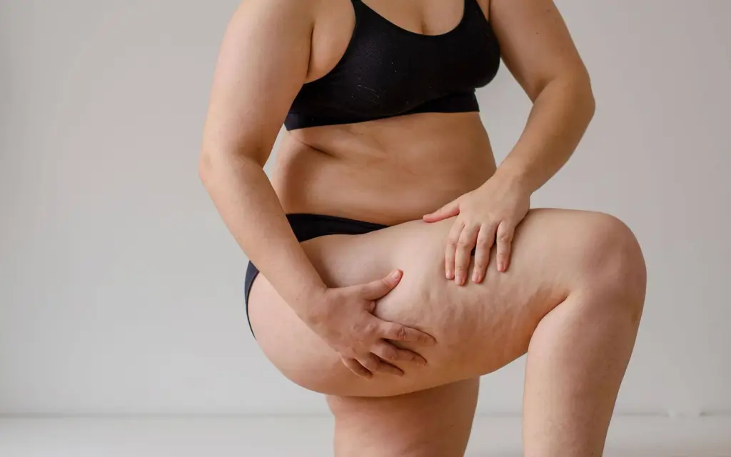 vaser liposuction side effects