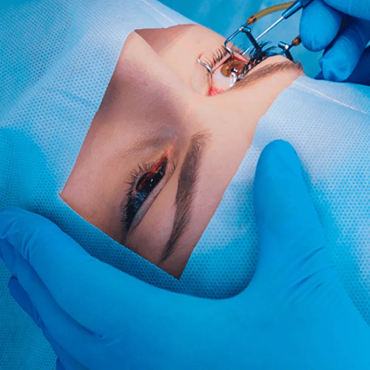 What is Vitrectomy? Surgery Steps, Recovery & Risks 3 vitrectomy