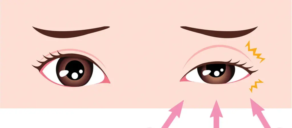what are eyeball spasms