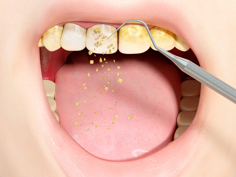 what is oral bacteria