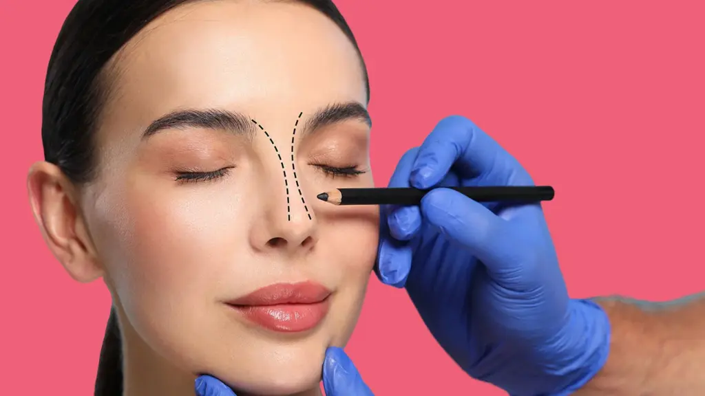 Revizyon Burun Ameliyatı: İyileşme Süreci, Kıkırdak Greftleri, Riskler ve Türkiye'deki Maliyetler 1 what is revision rhinoplasty