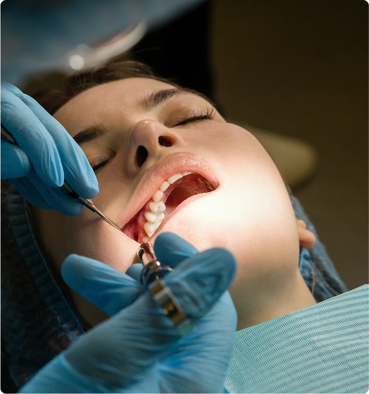 what to eat after wisdom teeth removal